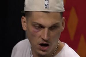NBA公牛vs灰熊_NBA公牛vs灰熊免下载直播_NBA公牛vs灰熊网页直接观看
